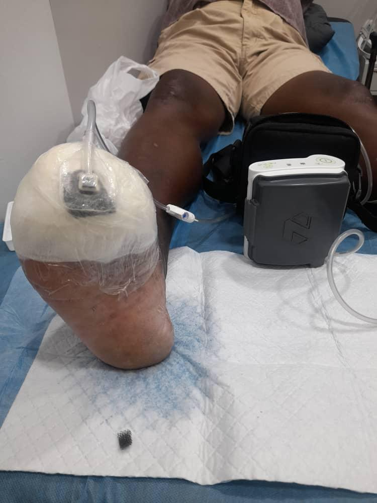 Wound Care & Diabetic Foot